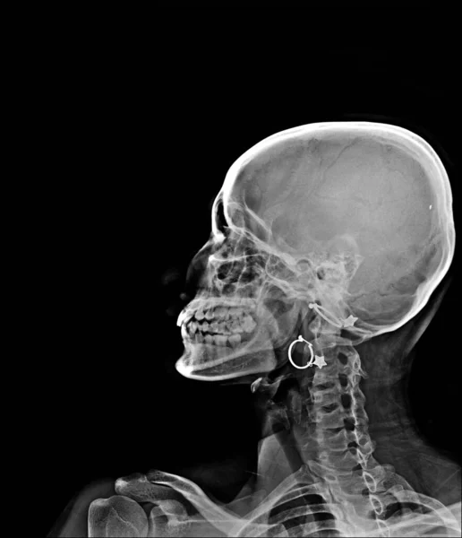human skeleton anatomy, x-ray scan, medical concept