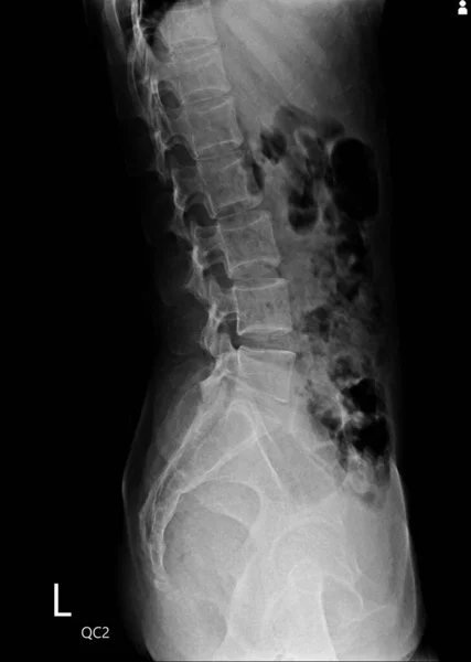 x-ray of human spine