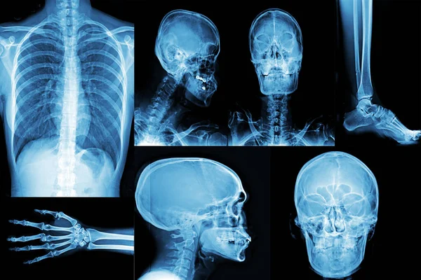 Collection X-ray human anatomy medical