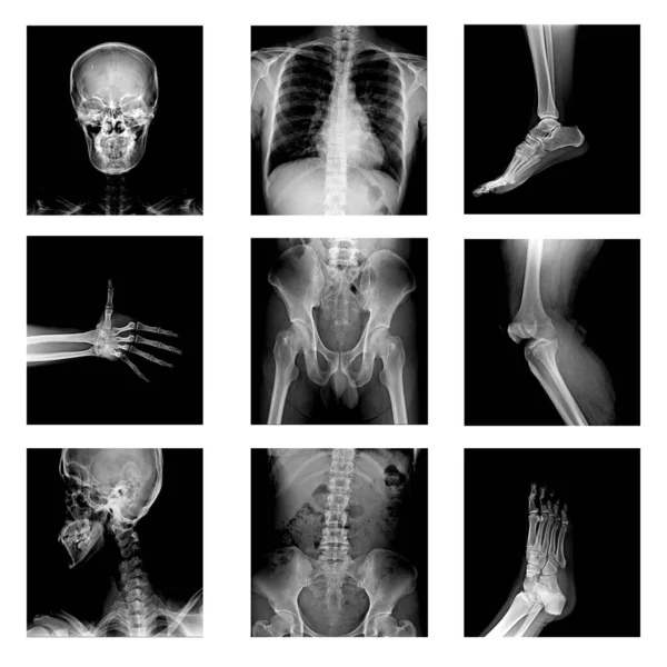 X-ray collages parts of the patient body