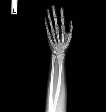 Siyah arkaplan içinde tıbbi ekipman olan insan elleri