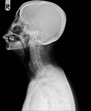 Akciğer anatomisi olan insan vücudu..