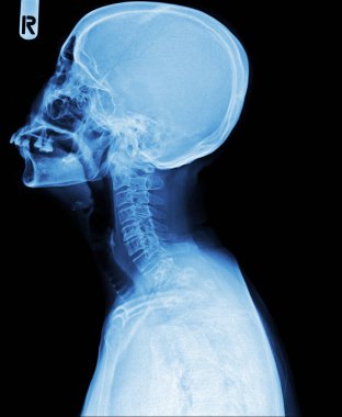 İnsan kemikleri, röntgen taraması.