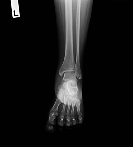 人間の骨や足の痛みイラスト — ストック写真