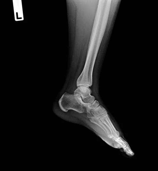 ヒトの骨格膝骨X線医療の概念図です — ストック写真