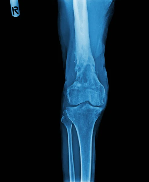 human anatomy, knee pain, x ray