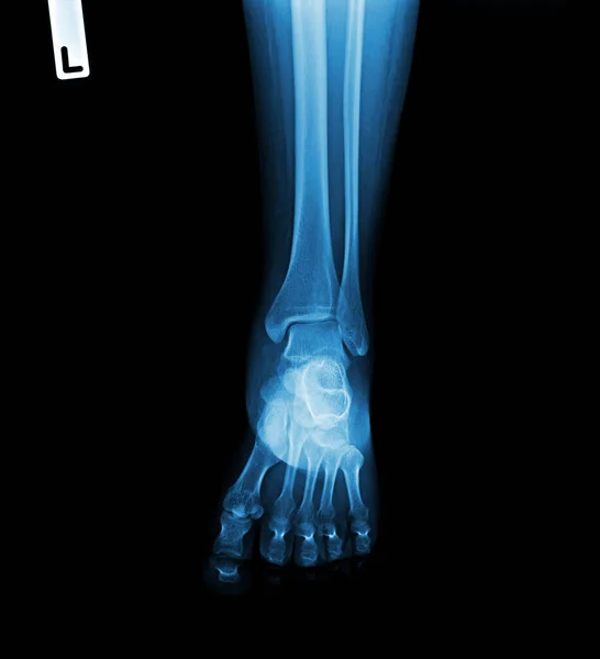 Menselijke Skelet Voet Knie Gezamenlijke Botten — Stockfoto