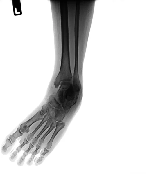 人間の骨の解剖学的関節 — ストック写真