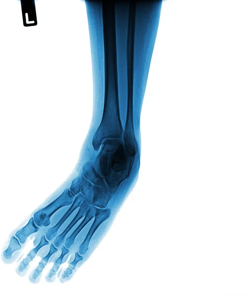 stock image human bones and foot pain, illustration