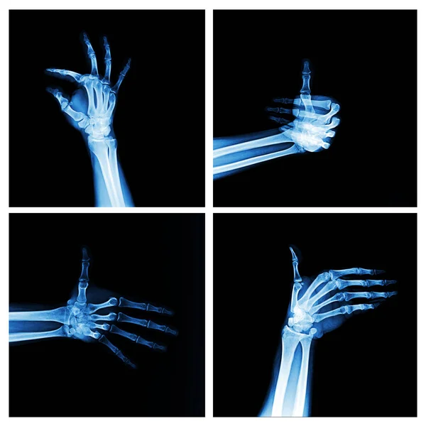 Anatomie Van Het Menselijk Lichaam Röntgenfoto Medische Zorg Gezondheidszorg Geneeskunde — Stockfoto