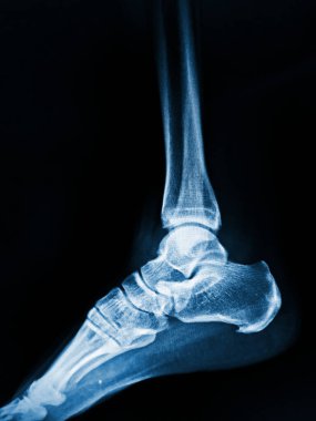 insan iskeleti x-ray