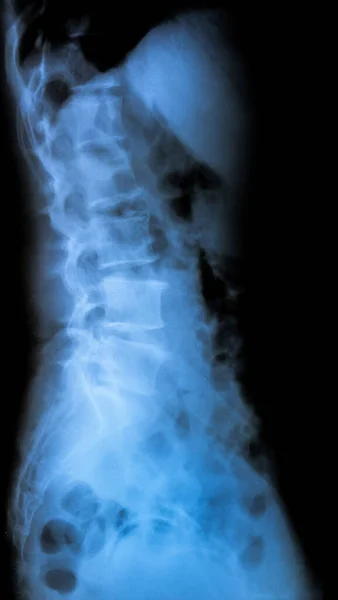 Doctor Neck Ray Image Medical Background — Stock Photo, Image
