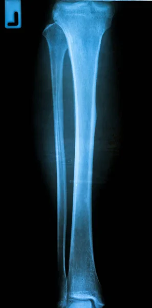 Esqueleto Humano Columna Radiografía — Foto de Stock