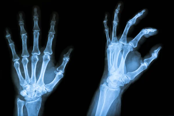人体解剖学扫描 X光和骨骼 — 图库照片
