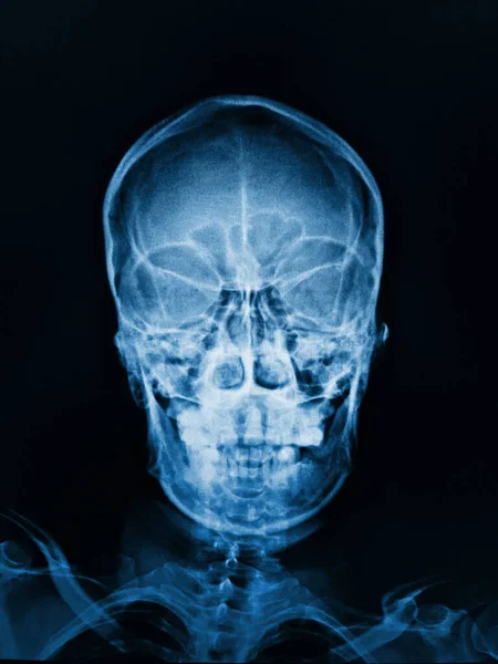 X光颅骨和有医疗面部的人体骨骼 — 图库照片