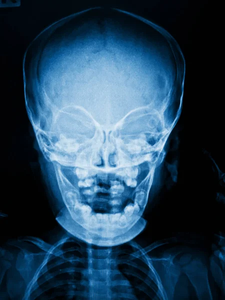 Siyah arka planda x-ray tıbbi anatomisinde insan yüzü.