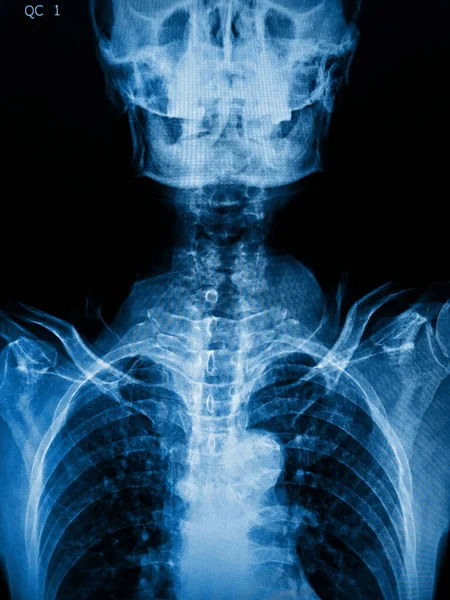 Röntgenbild Mänskliga Ben — Stockfoto