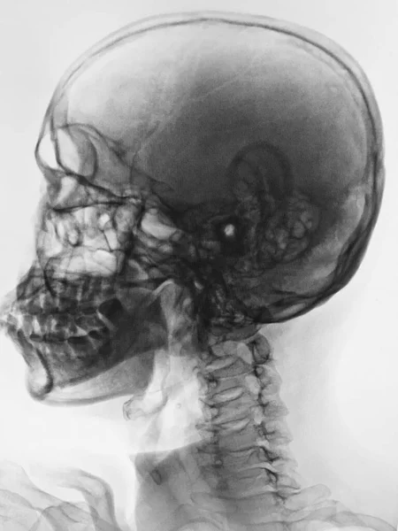 Анатомия Человеческого Мозга Ray — стоковое фото