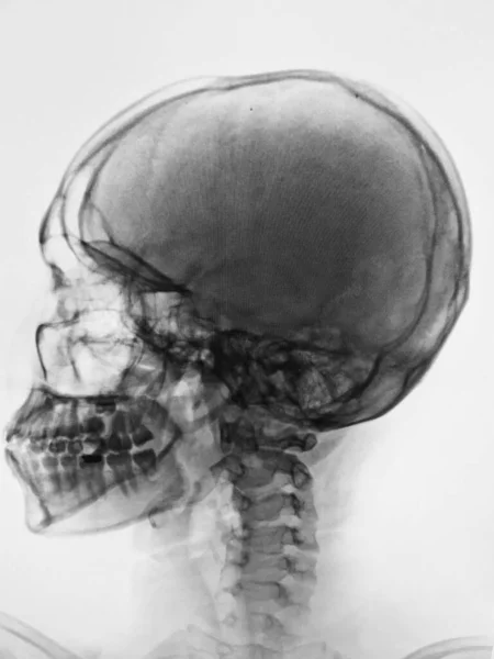 Human Skeleton Anatomy Ray Scan Digital Illustration — Fotografia de Stock