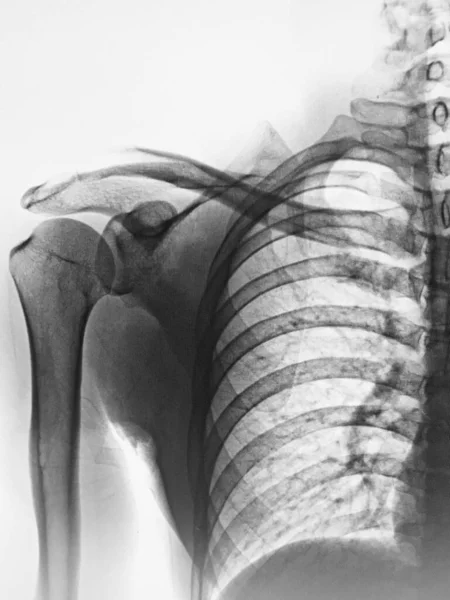Human Spine Anatomy Ray — Stock Photo, Image