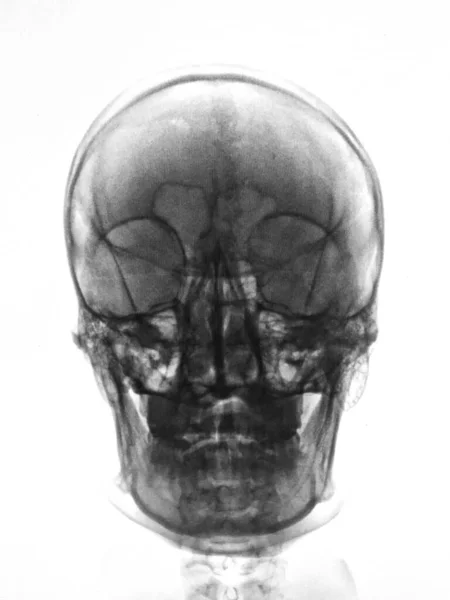 人体颅骨解剖 医疗概念 — 图库照片