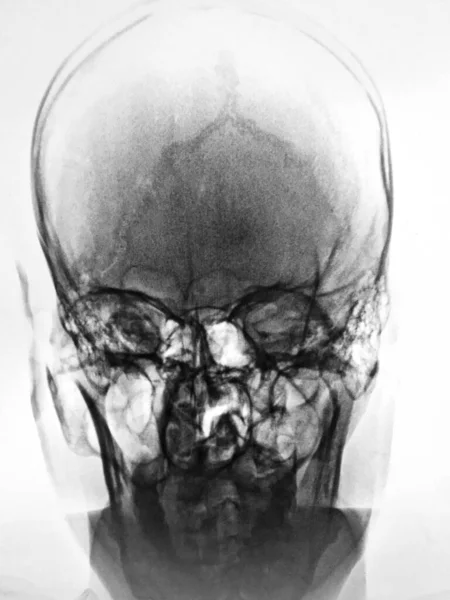 人体颅骨解剖 3D说明 — 图库照片