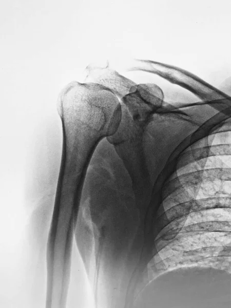 Анатомія Людини Рентгенівський — стокове фото