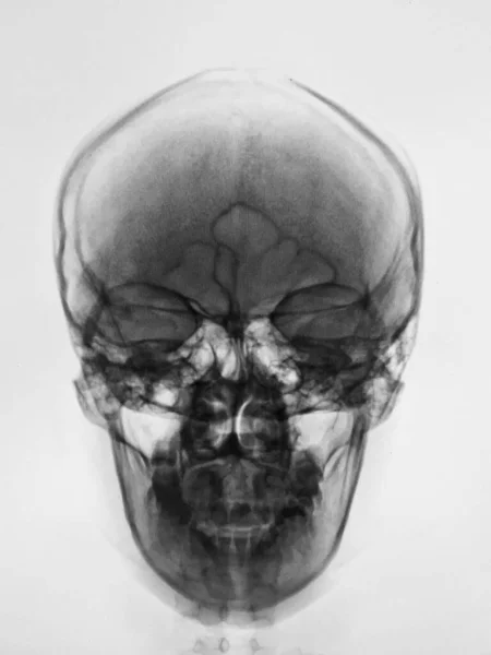 Human Skull Anatomy Medical Concept — Fotografia de Stock
