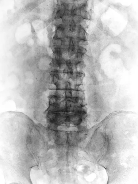 Abstract Illustration Human Skeleton — Stock Photo, Image