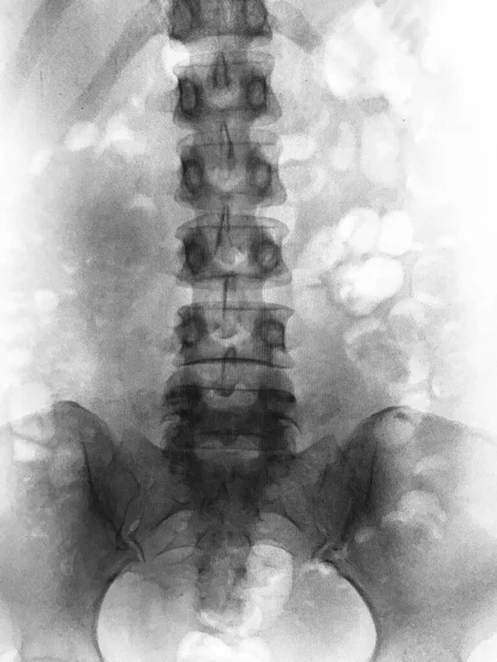 Abstract Picture Human Spine — Stock Photo, Image