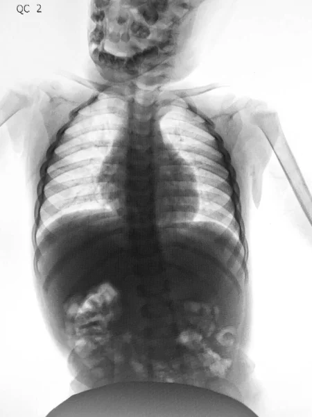 Human Anatomy Scan Ray Image — Stock Photo, Image
