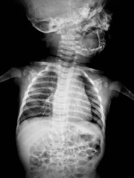 Human Body Ray Scan — Stock Photo, Image