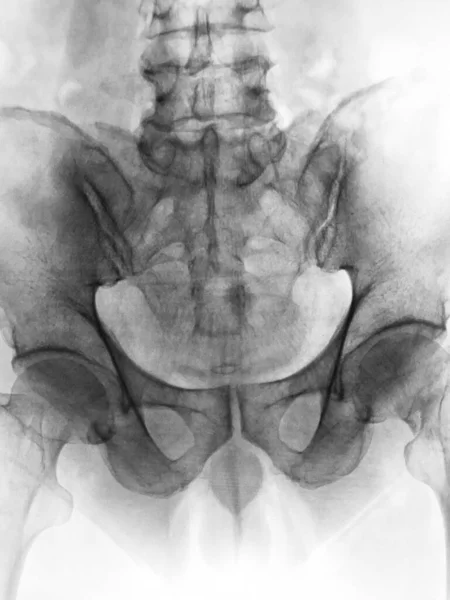 Anatomie Cérébrale Humaine Radiographie — Photo