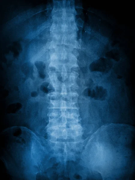 stock image x-ray of human spine