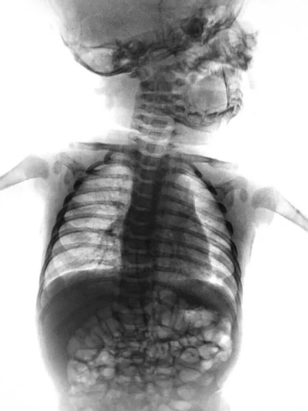 Human Anatomy Scan Spine — Stok Foto