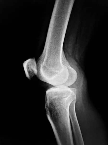 Анатомія Хребта Людини Рентгенівський — стокове фото