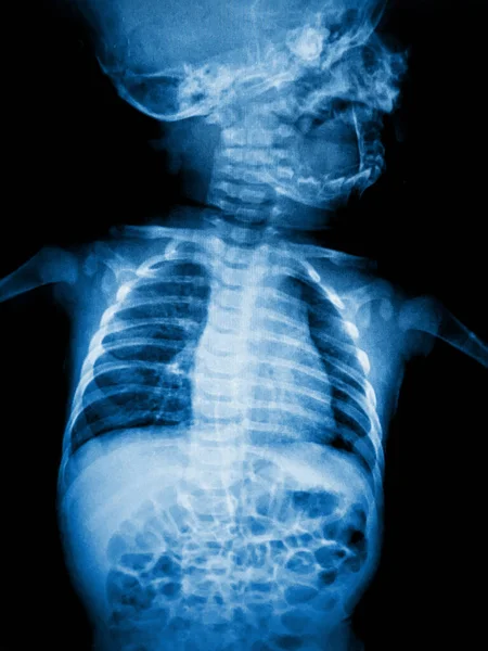 人体脊柱X光扫描 — 图库照片