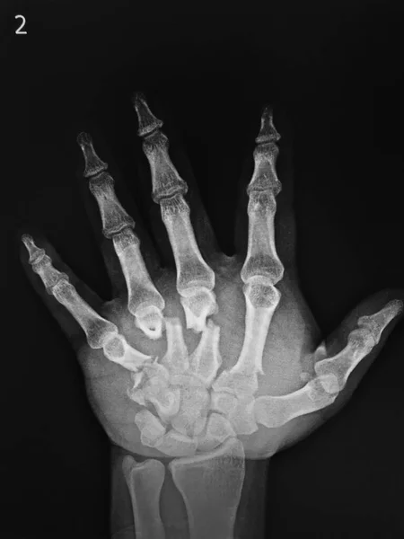 Χέρι Που Κρατά Μια Ακτινογραφία Του Ανθρώπινου Σώματος — Φωτογραφία Αρχείου