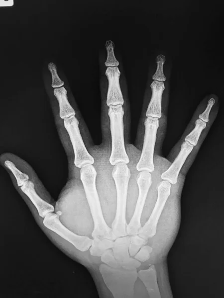 Χέρι Που Κρατά Σκελετό Θηλυκού Χεριού — Φωτογραφία Αρχείου