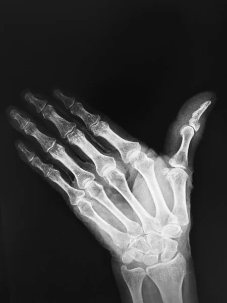 人的手与X光图像 — 图库照片