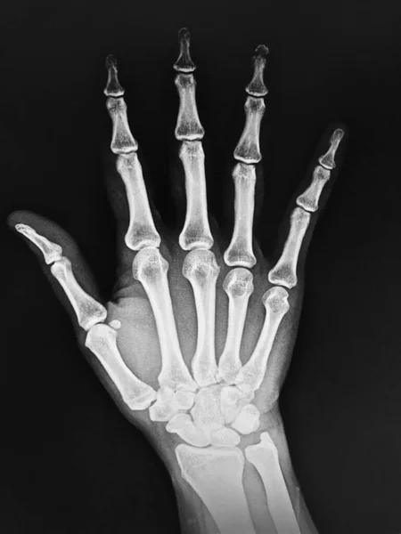 Анатомія Людського Скелета Ілюстрація — стокове фото