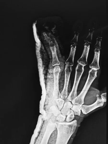 Рентгенівське Зображення Людського Тіла — стокове фото