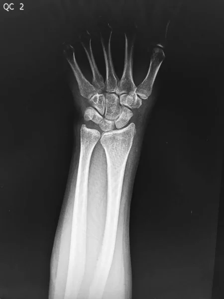 Анатомія Людського Скелета Рентгенівський — стокове фото
