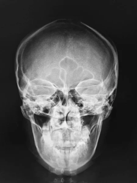 Anatomia Cérebro Humano Raio Conceito Médico — Fotografia de Stock