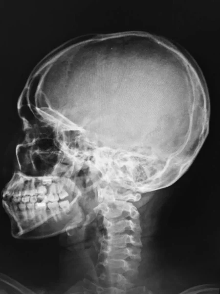 Рентгеновское Сканирование Человеческого Тела — стоковое фото