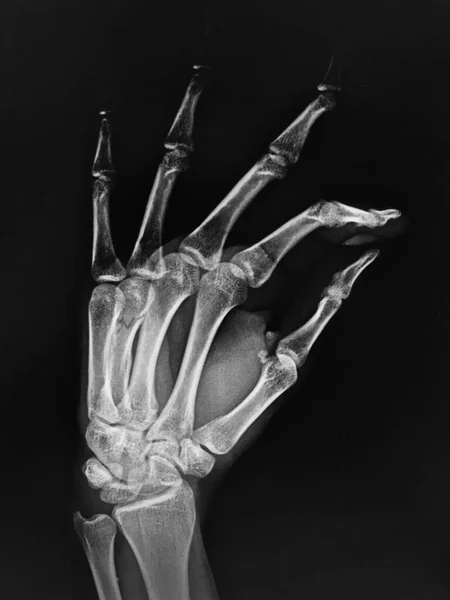 Анатомія Людського Скелета Медична Концепція — стокове фото
