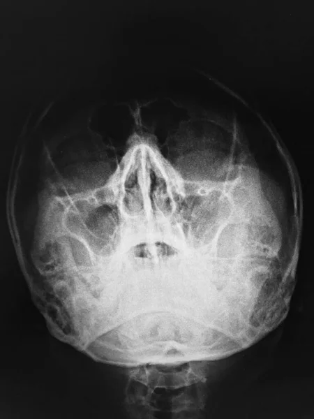 Ray Image Human Brain — Stock Photo, Image