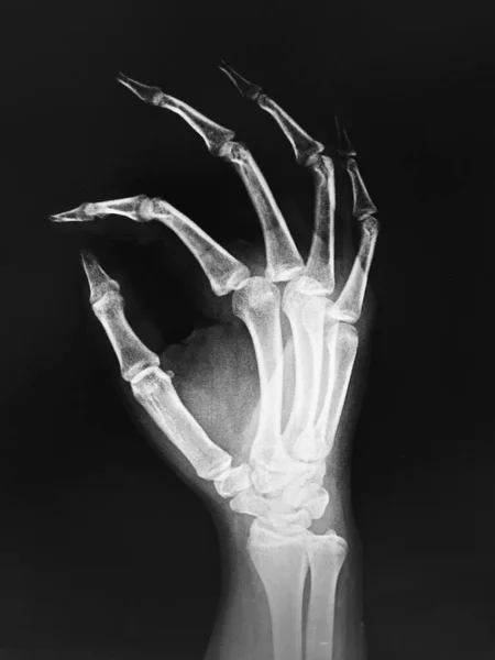 Ανατομία Ανθρώπινου Σκελετού Ιατρική Έννοια — Φωτογραφία Αρχείου