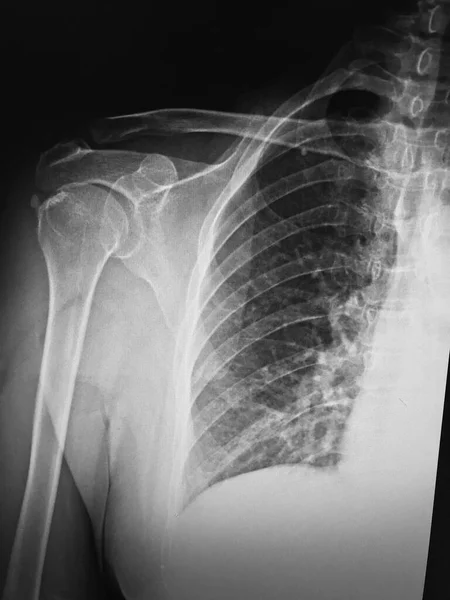 Radiografia Del Corpo Umano — Foto Stock