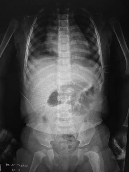 Nsan Vücudunun Röntgeni — Stok fotoğraf